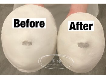 美極 トータルビューティー(美極 TOTAL BEAUTY)/恵比寿/小顔コルギ/エステ/