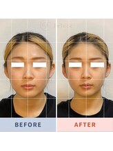 サロン ド フェルーチェ(salon de Feluce)/小顔矯正