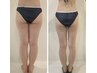 【脚スリムにしたい】骨盤矯正×全身筋膜ケア×脚ハイパーナイフ×吸引120分