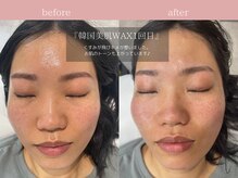 ジョリー(JOLi)/顔脱毛/韓国美肌ワックス