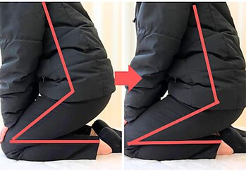 杉本接骨鍼灸院/膝の症状例：施術を受けた方の声