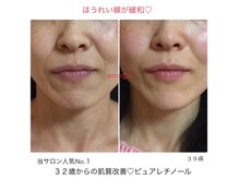 リュミエールボーテ/人気No.１★ピュアレチノール