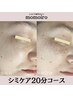 夏でもできる！頬周りや気になるポイントに♪【シミケア放題 20分コース】 