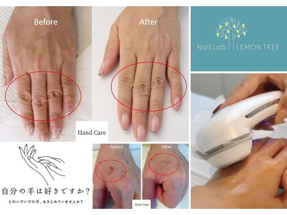 ネイルラボ レモンツリー(Nail Lab LEMON TREE)の写真