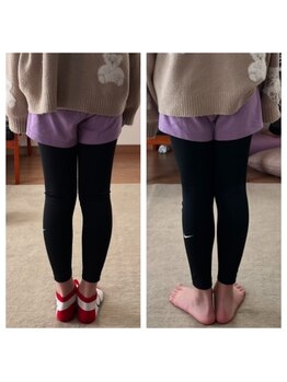 ララ(LARA)/Ｏ脚改善