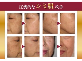 エステサロンパリス(Esthe Salon Paris)