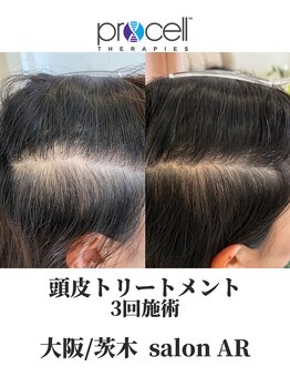 サロン アール(salon AR)/プロセルセラピーズ