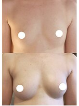 プレジール/バストボリュームアップ