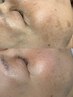 【シミ集中リセット】厚塗り・隠し肌卒業｜くすみ・色むら・赤みを整え透明感