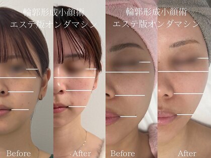 ライフサロン 天神(Life Salon)の写真