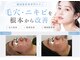 ユアーズ ビューティー(YOURS beauty)の写真/毛穴・ニキビを根本からケア。憧れの韓国女優のような透明感あふれる水光ツヤ肌へ導きます