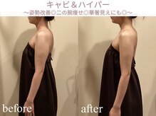 エステティックサロン アールグレー 名古屋駅店/花嫁も絶賛♪姿勢美人◎