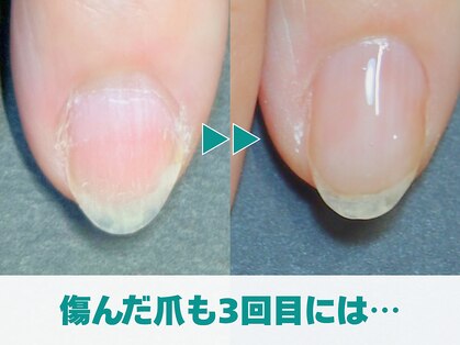 キラリネイル(KIRARINAIL)の写真