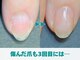 キラリネイル(KIRARINAIL)の写真