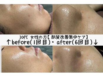 サロンスペース/肌質改善集中ケア