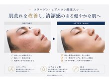 ヴィヴィ(ViVi)の雰囲気(メンズフェイシャル)