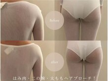 ルモラビューティー 水天宮前店(LUMORABEAUTY)