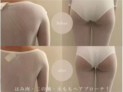 ルモラビューティー 水天宮前店(LUMORABEAUTY)の写真