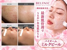 ルーセント