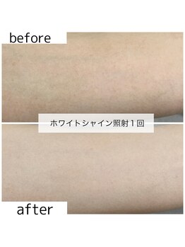 リブ(Lib)/ホワイトシャイン