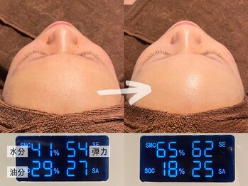 ルーナジェーナ(Luna llena)/