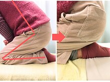 杉本接骨鍼灸院/膝の症状例：施術を受けた方の声