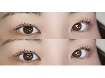 ジープラス(G+)/韓国風ラッシュリフト