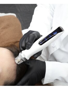 ヒカリ 淡路店(HIKARI)/「頭皮の透け」対策に！