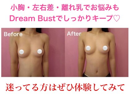 ドリームバスト 中崎町(Dream Bust)の写真