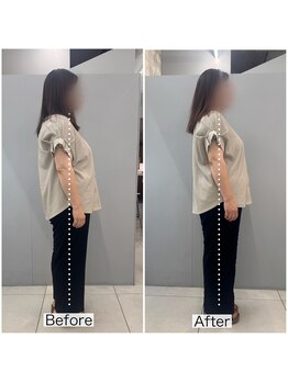 シャウルデッサン(CHARLESDESSIN)/フェムケア矯正