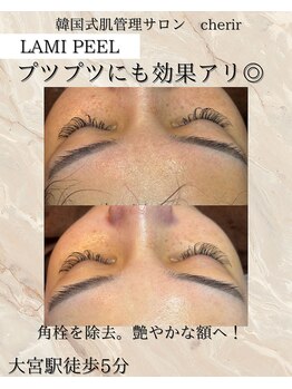 シェリール 大宮(cherir)/