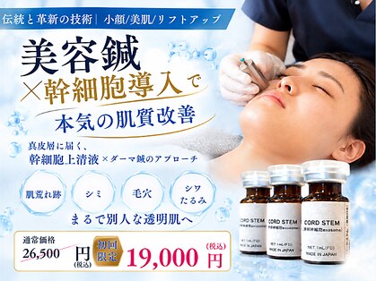 美容鍼 鍼灸治療院 優の輪の写真