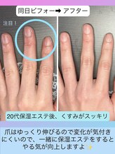 桃の木 吉祥寺店/保湿ケアだけでくすみが取れます