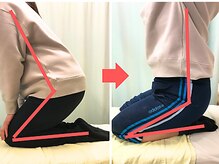 杉本接骨鍼灸院/膝の症状例：施術を受けた方の声