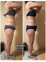 ヨサパーク ハット(YOSA PARK HAT)/ぽっこりお腹も減っこみます