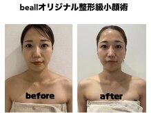 ビオール 表参道(beall)の雰囲気（beallオリジナル小顔術は5年連続結果満足度100%♪）