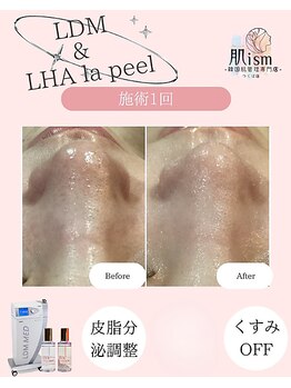 肌イズム つくば店(肌ism)/ララピール×LDM