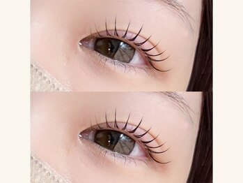 シーンスタジオ 熊本店(SSIN STUDIO)/人気のメーテルロッド