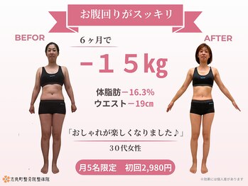 志免町整骨院/6ヶ月ダイエット