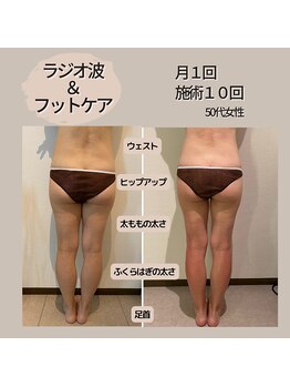 モーイエンチャーム(mooi en charme)の写真/その脚、まだ諦めないで！ラジオ波×独自ハンドで叶える美脚解放！自信も変わる集中ケア☆