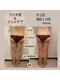 モーイエンチャーム(mooi en charme)の写真/その脚、まだ諦めないで！ラジオ波×独自ハンドで叶える美脚解放！自信も変わる集中ケア☆