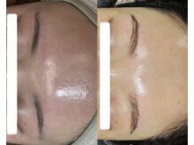 ルーク(Luke)の雰囲気(繰り返すニキビに、本気の肌改善ケア☆陶器のような肌へ。)