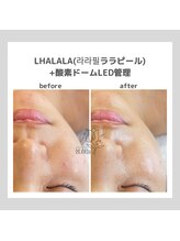 ポムハヌル(pom.haneul)/韓国肌管理室