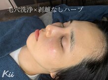 キー(kii)/小倉で肌管理するならKiiに！