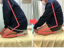 杉本接骨鍼灸院/膝の症状例：施術を受けた方の声