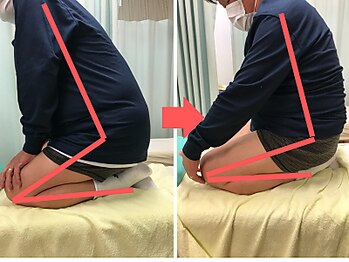 杉本接骨鍼灸院/膝の症状例:施術を受けた方の声