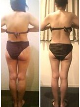 ラヴィニティ 自由が丘店(Lavinity)/【30代】ビフォー、アフター