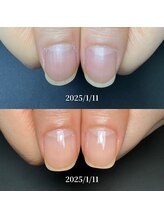 ココ(COCO)/お客様に寄り添う深爪改善