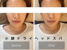 ラヴァンド(Lavande)の雰囲気（リラクゼーションでは終わらない！小顔も叶えるドライヘッドスパ）