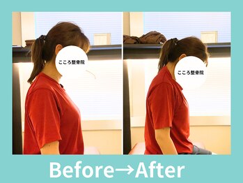 こころ整骨院/30代女性のビフォーアフター